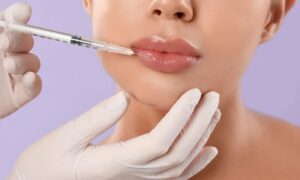 A woman getting her lips waxed by a doctor.