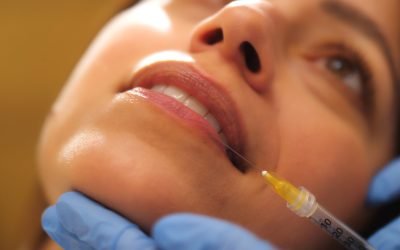 Dermal filler treatment in Greenville SC for natural facial balancing and volume restoration