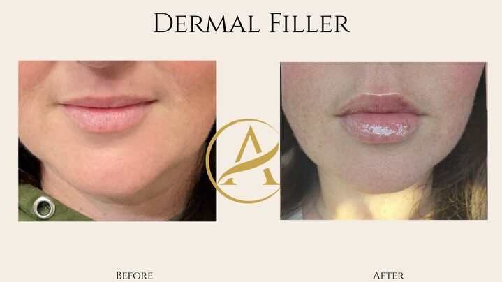 Instagram post from auraaestheticsgvl. This post is in position 1.