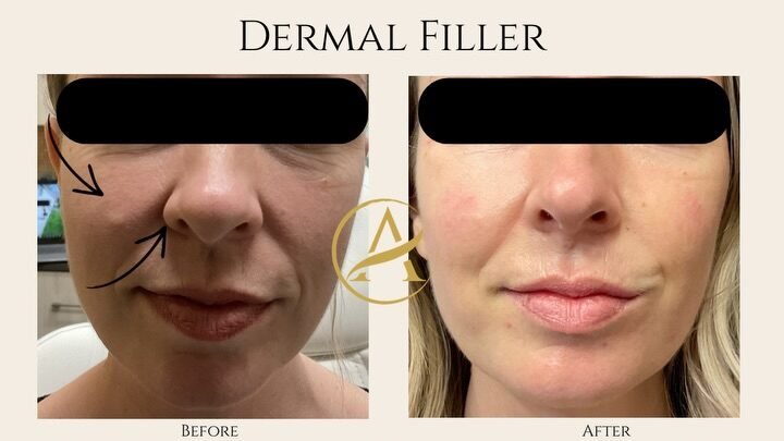 Instagram post from auraaestheticsgvl. This post is in position 1.