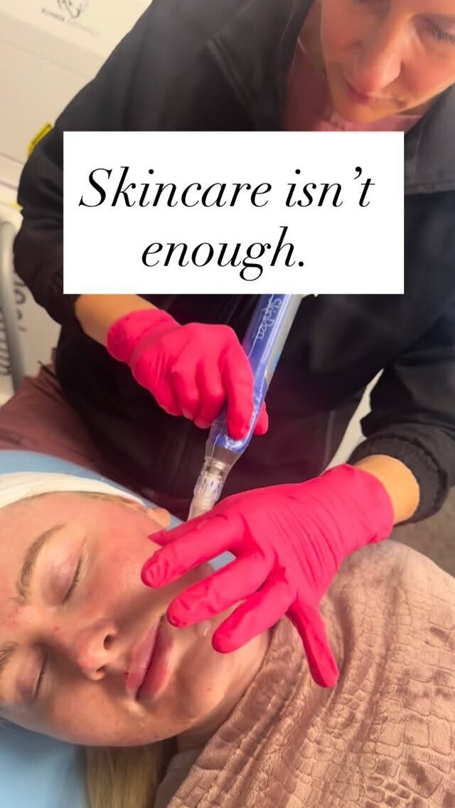 Instagram post from auraaestheticsgvl. This post is in position 1.