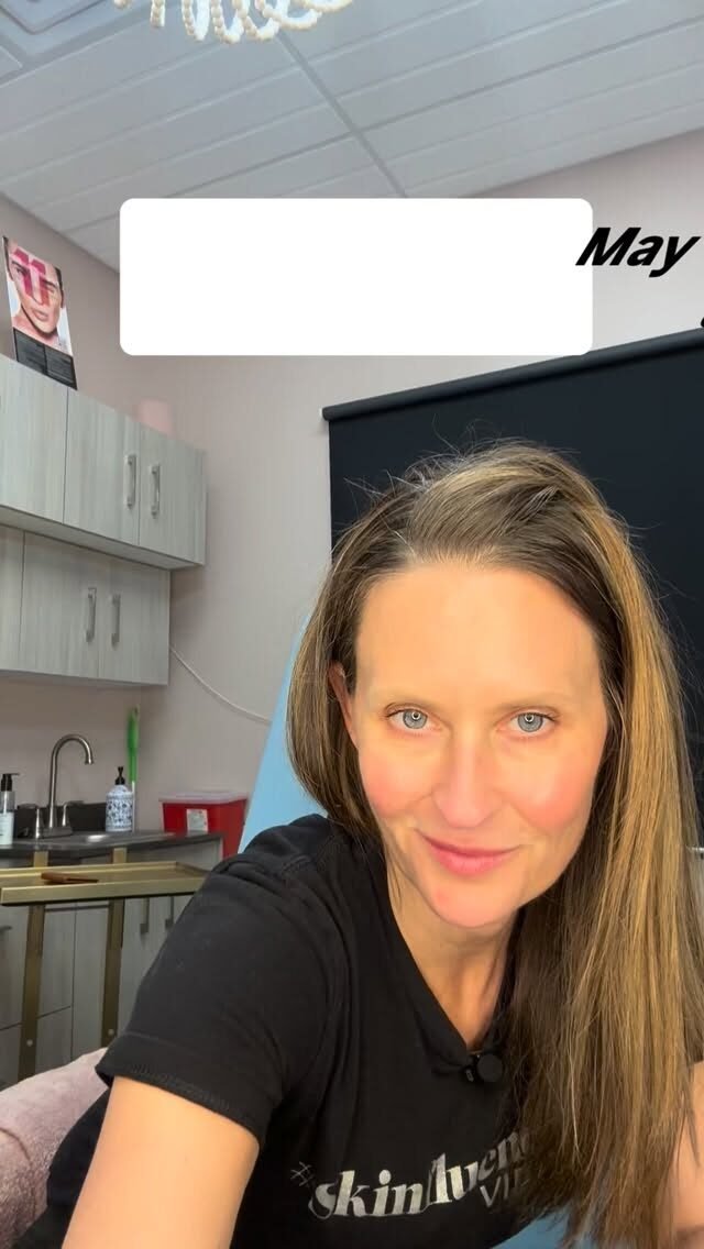 Instagram post from auraaestheticsgvl. This post is in position 1.